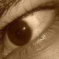 Cataract Eye Drops